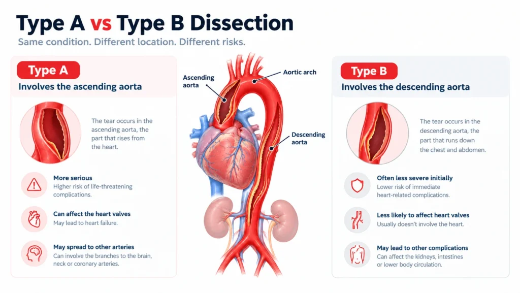 Type A vs Type B Aortic Dissection